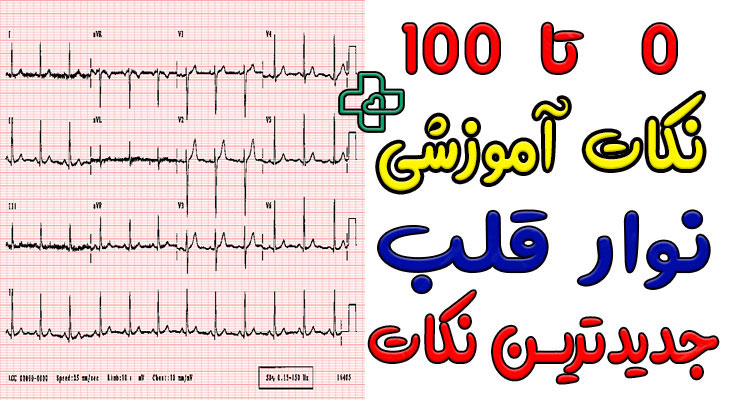 نوار قلب