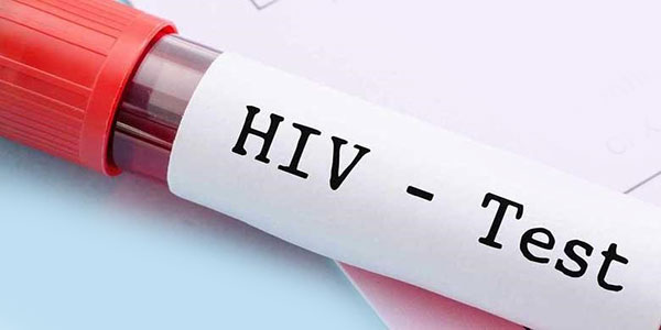 آزمایش ایدز در منزل