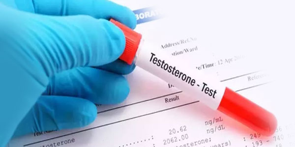 آزمایش تستسترون