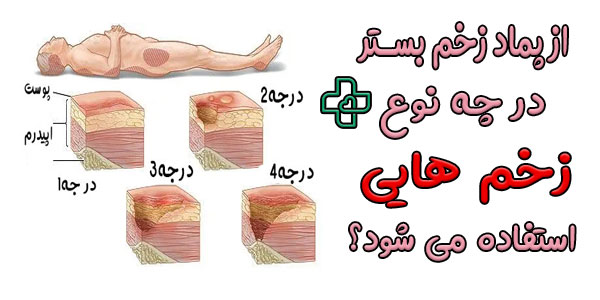 از پماد برای زخم بستر در چه نوع زخم هایی می توان استفاده نمود؟