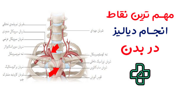 از کدام قسمت های بدن دیالیز انجام می شود؟