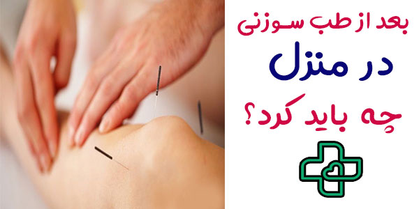 بعد از انجام طب سوزنی در منزل چه باید کرد؟