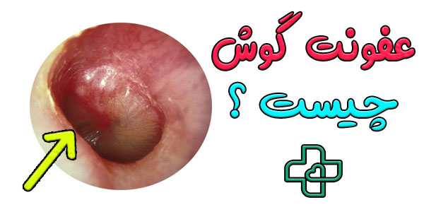 عفونت گوش چیست؟