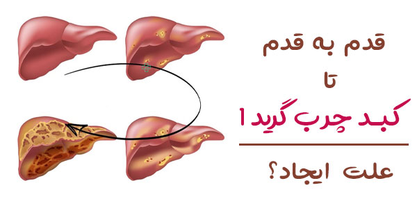 علت ایجاد کبد چرب چیست؟