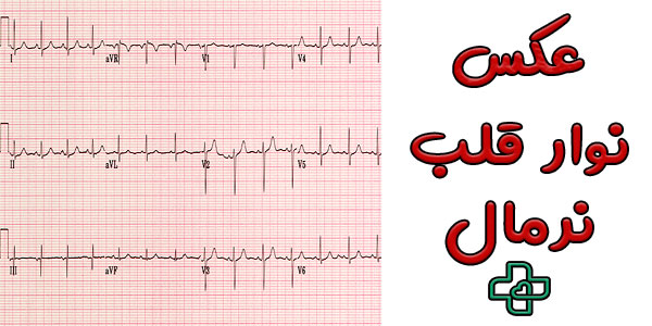 عکس نوار قلب نرمال