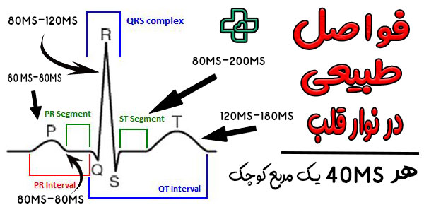 فواصل بین هر موج در نوار قلب و نکات آن