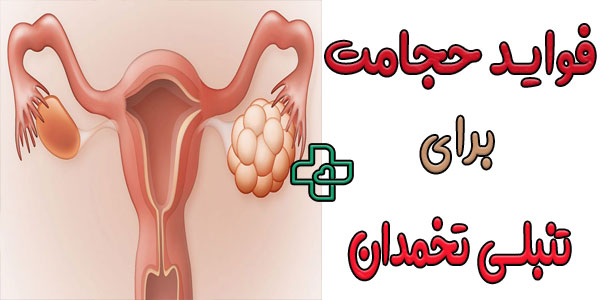 درمان تنبلی تخمدان با حجامت یا بادکش درمانی