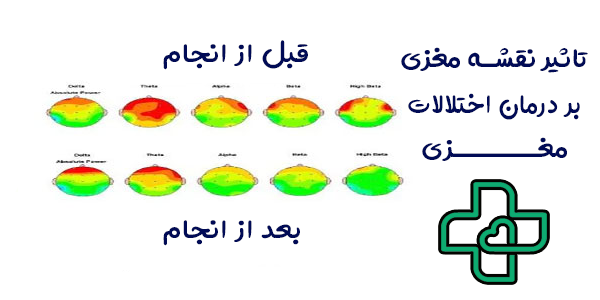 نقشه مغزی چیست؟ تفاوت نقشه مغزی با نوار مغز چیست؟