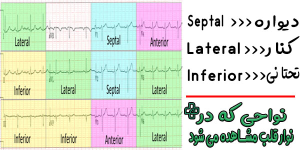 نوار قلب کدام نواحی قلب را نشان می دهد؟