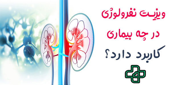 ویزیت پزشک متخصص کلیه در منزل در چه بیماری هایی مورد استفاده قرار می گیرد؟