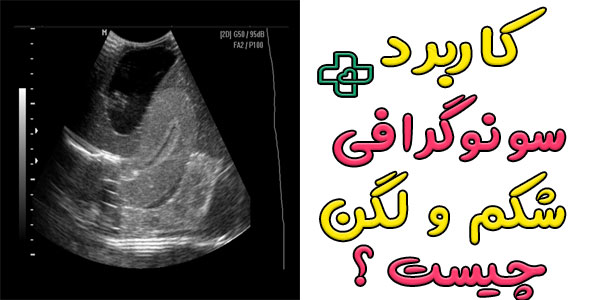 کاربرد های استفاده از سونوگرافی شکم و لگن چیست؟